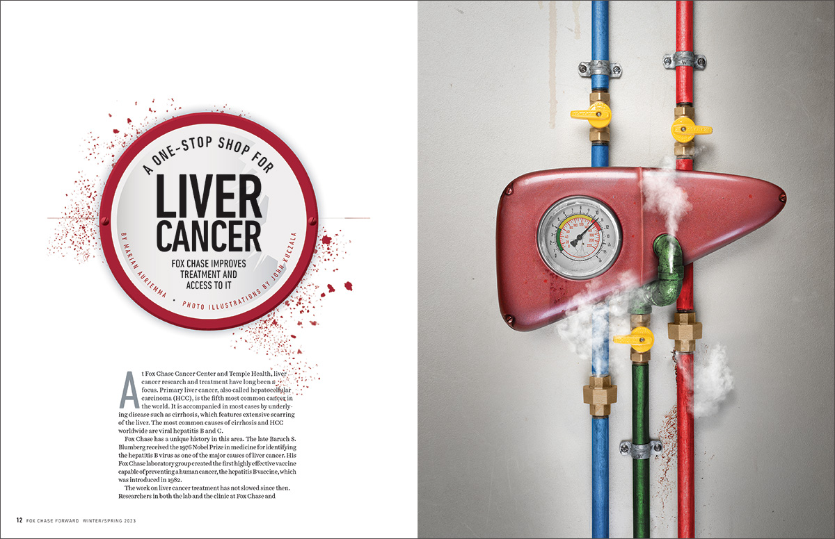 fox-chase-forward-liver-winter-2023